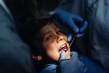 miniatura leczenie zęba dziecka